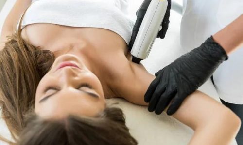 Experience the Future of Hair Removal in Alexandria with Laser Technology